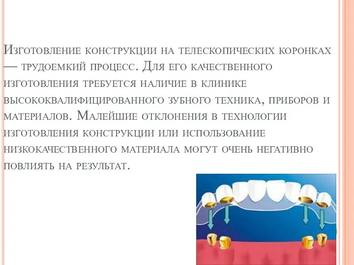 Изготовление конструкции на телескопических коронках — трудоемкий процесс. Для его качественного