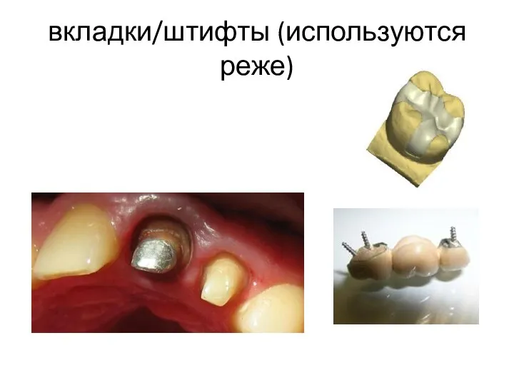 вкладки/штифты (используются реже)