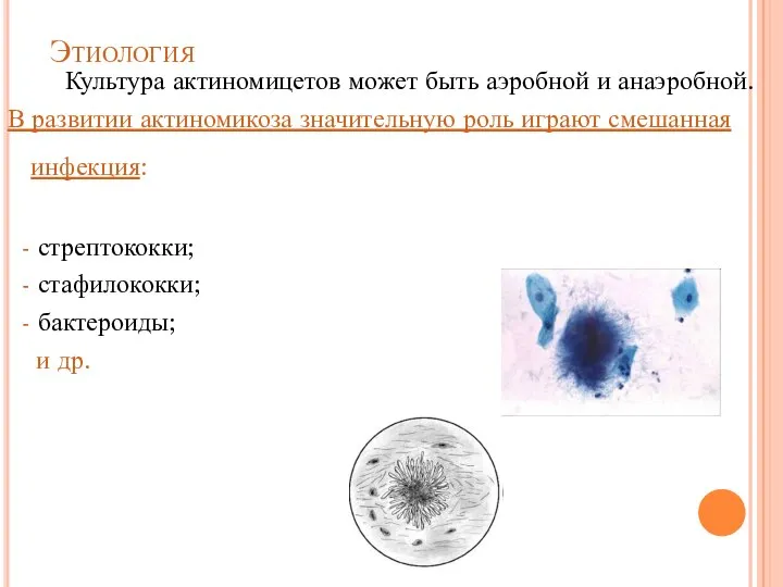 Этиология Культура актиномицетов может быть аэробной и анаэробной. В развитии актиномикоза