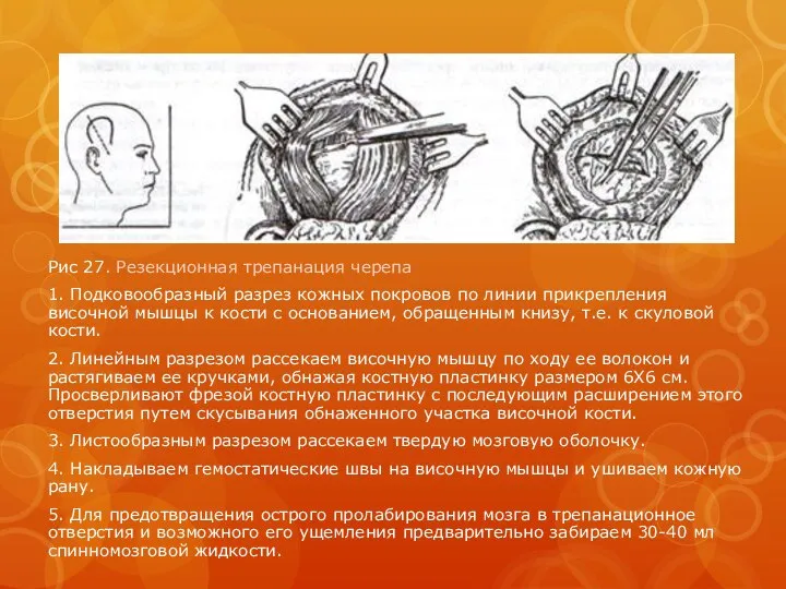 Рис 27. Резекционная трепанация черепа 1. Подковообразный разрез кожных покровов по