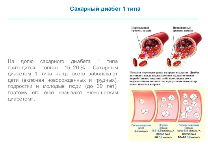 Сахарный диабет 1 типа На долю сахарного диабета 1 типа приходится