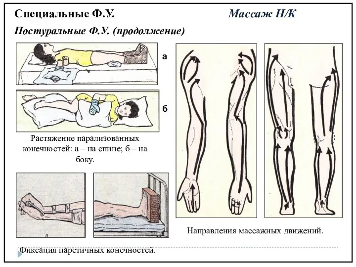 Специальные Ф.У. Массаж Н/К Постуральные Ф.У. (продолжение)‏ Растяжение парализованных конечностей: а