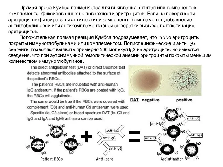 Прямая проба Кумбса применяется для выявления антител или компонентов комплемента, фиксированных