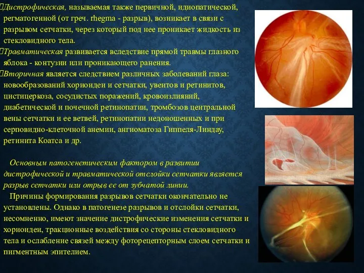 Дистрофическая, называемая также первичной, идиопатической, регматогенной (от греч. rhegma - разрыв),