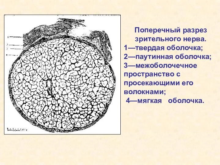 Поперечный разрез зрительного нерва. 1—твердая оболочка; 2—паутинная оболочка; 3—межоболочечное пространство с просекающими его волокнами; 4—мягкая оболочка.