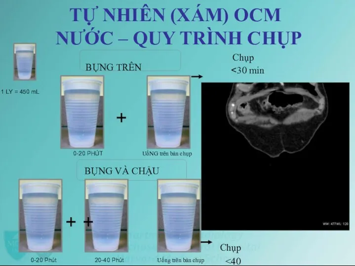 TỰ NHIÊN (XÁM) OCM NƯỚC – QUY TRÌNH CHỤP Chụp BỤNG