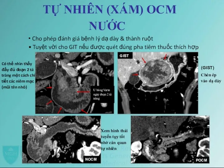 TỰ NHIÊN (XÁM) OCM NƯỚC • Cho phép đánh giá bệnh