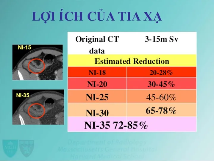 LỢI ÍCH CỦA TIA XẠ Original CT data 3-15m Sv NI-15