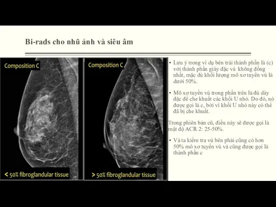 Bi-rads cho nhũ ảnh và siêu âm Lưu ý trong ví