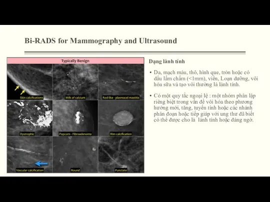 Bi-RADS for Mammography and Ultrasound Dạng lành tính Da, mạch máu,