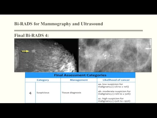 Bi-RADS for Mammography and Ultrasound Final Bi-RADS 4: