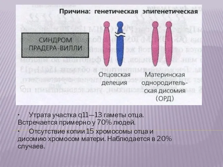 • Утрата участка q11—13 гаметы отца. Встречается примерно у 70% людей.