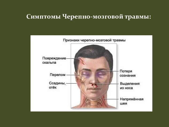 Симптомы Черепно-мозговой травмы: