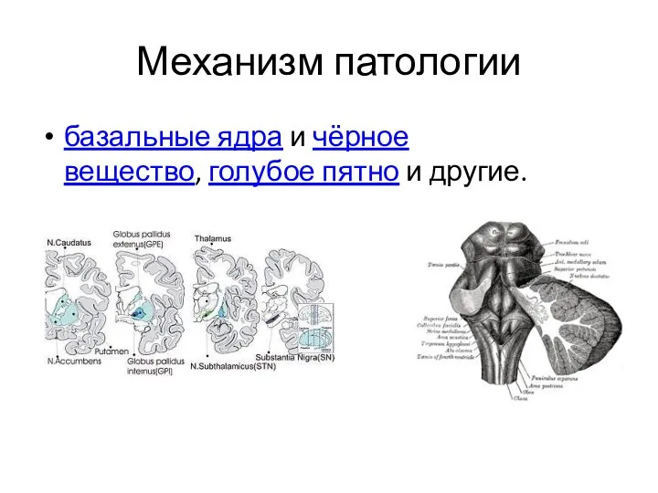 Механизм патологии базальные ядра и чёрное вещество, голубое пятно и другие.