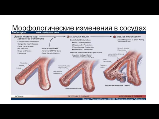 Морфологические изменения в сосудах