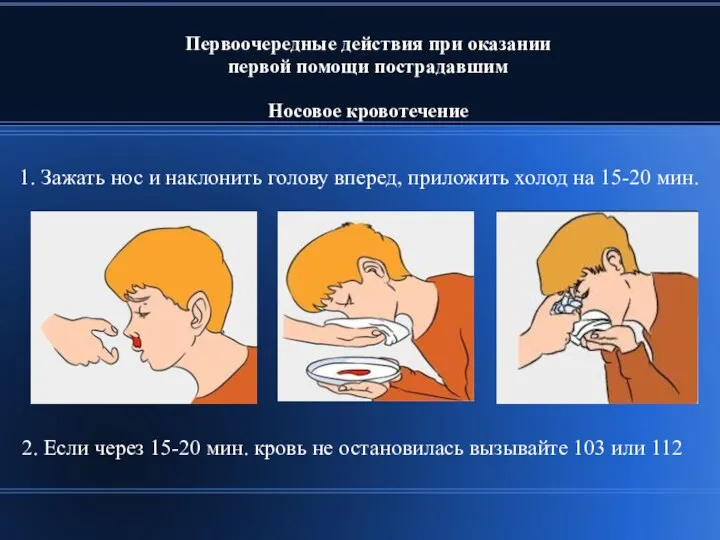 Первоочередные действия при оказании первой помощи пострадавшим Носовое кровотечение 1. Зажать