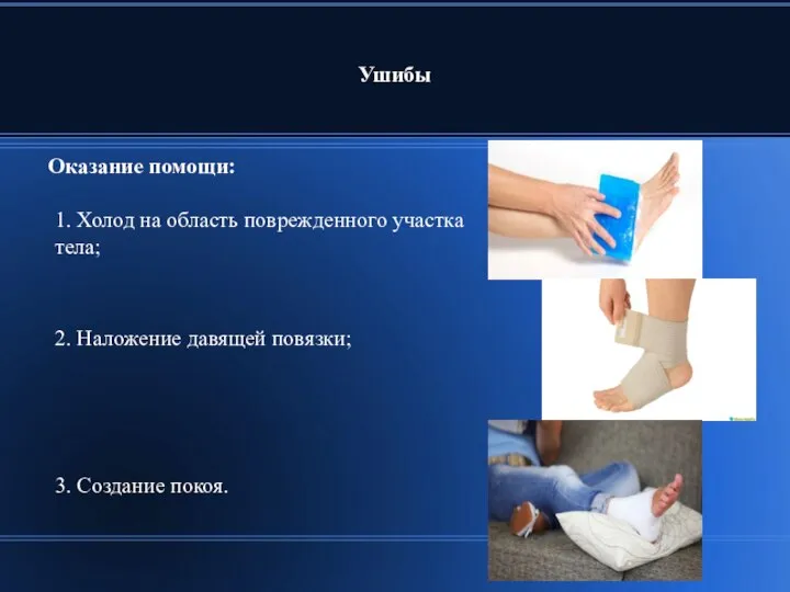 Ушибы Оказание помощи: 2. Наложение давящей повязки; 3. Создание покоя. 1.