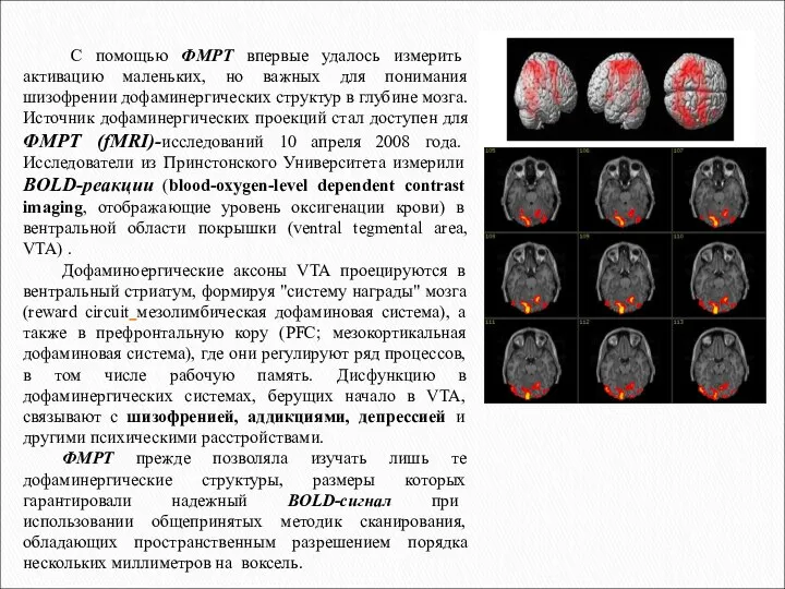 С помощью ФМРТ впервые удалось измерить активацию маленьких, но важных для