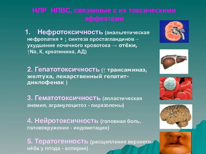 НЛР НПВС, связанные с их токсическими эффектами Нефротоксичность (анальгетическая нефропатия +