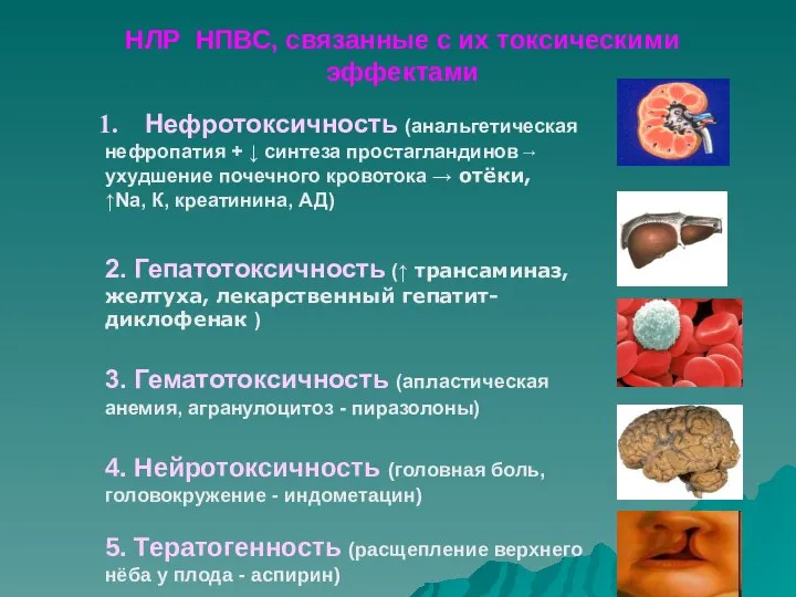 НЛР НПВС, связанные с их токсическими эффектами Нефротоксичность (анальгетическая нефропатия +