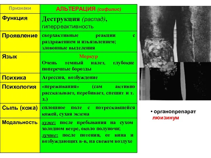 органопрепарат люизинум