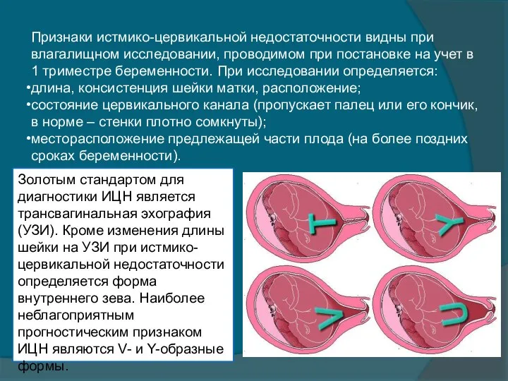 Золотым стандартом для диагностики ИЦН является трансвагинальная эхография (УЗИ). Кроме изменения