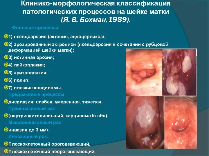 Клинико-морфологическая классификация патологических процессов на шейке матки (Я. В. Бохман, 1989).