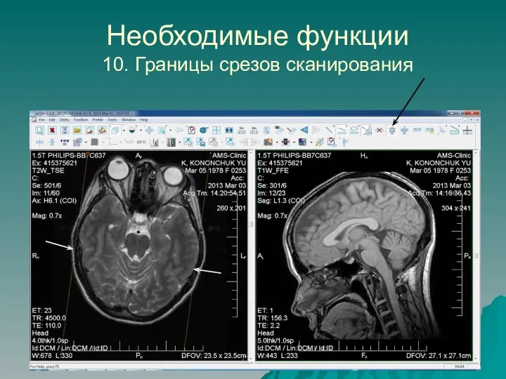 Необходимые функции 10. Границы срезов сканирования