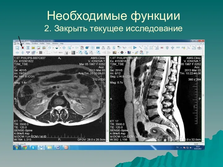 Необходимые функции 2. Закрыть текущее исследование