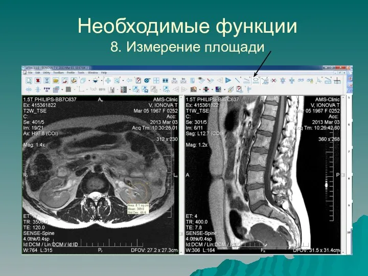 Необходимые функции 8. Измерение площади