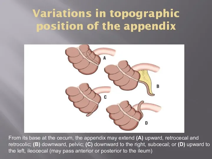 Variations in topographic position of the appendix From its base at