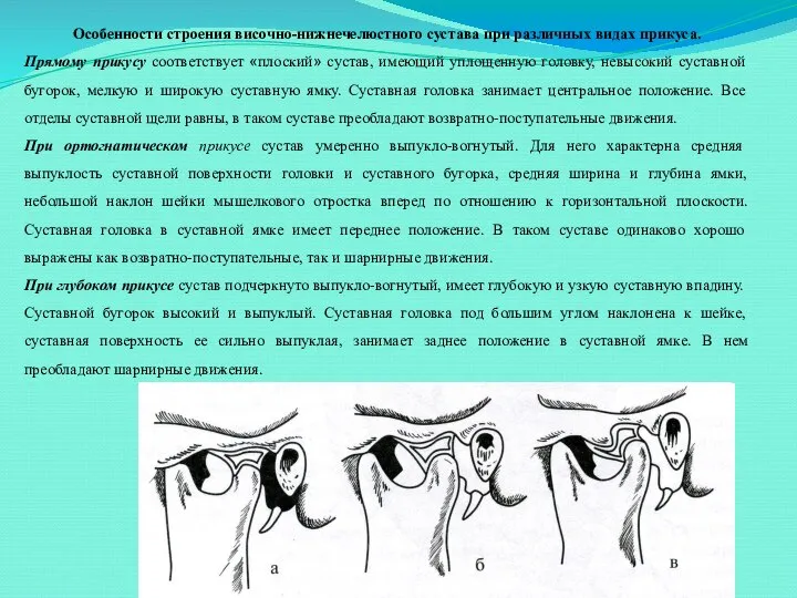 Особенности строения височно-нижнечелюстного сустава при различных видах прикуса. Прямому прикусу соответствует