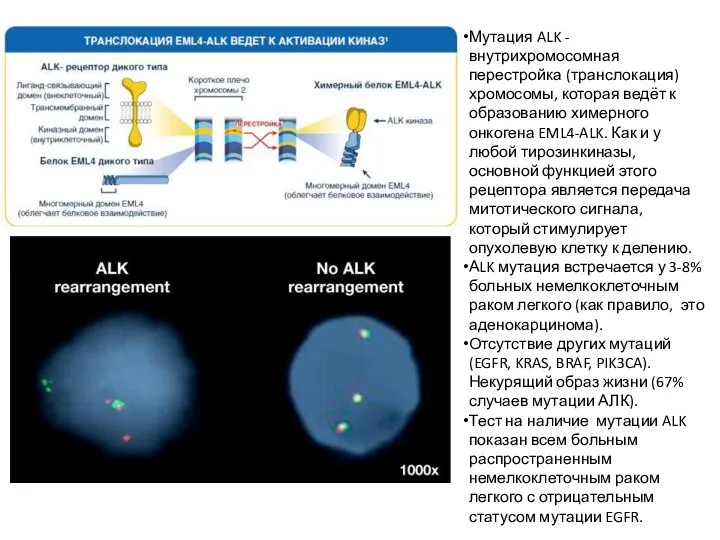 Мутация ALK - внутрихромосомная перестройка (транслокация) хромосомы, которая ведёт к образованию