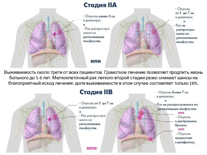 Выживаемость около трети от всех пациентов. Грамотное лечение позволяет продлить жизнь