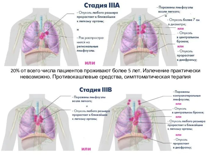 20% от всего числа пациентов проживают более 5 лет. Излечение практически невозможно. Противокашлевые средства, симптоматическая терапия