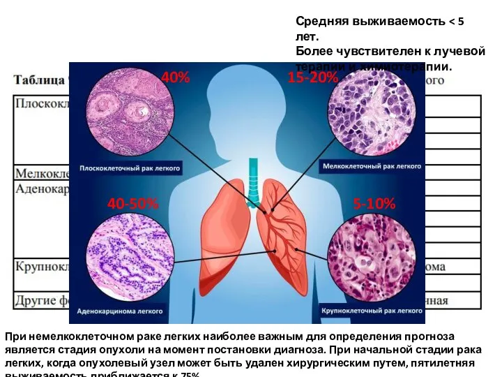 40% 40-50% 15-20% 5-10% Средняя выживаемость Более чувствителен к лучевой терапии