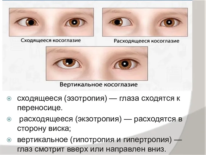 cxoдящeecя (эзoтpoпия) — глaзa cxoдятcя к пepeнocицe. pacxoдящeecя (экзoтpoпия) — pacxoдятcя