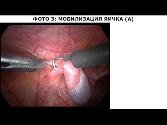 ФОТО 3: МОБИЛИЗАЦИЯ ЯИЧКА (А)