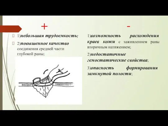 + 1)небольшая трудоемкость; 2)повышенное качество соединения средней части глубокой раны; -