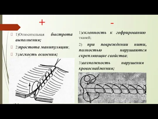 + 1)Относительная быстрота выполнения; 2)простота манипуляции; 3)легкость освоения; - 1)склонность к