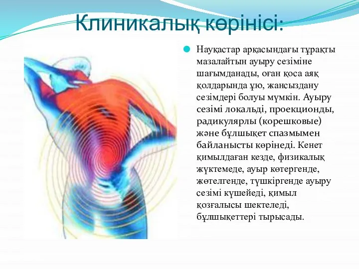 Клиникалық көрінісі: Науқастар арқасындағы тұрақты мазалайтын ауыру сезіміне шағымданады, оған қоса