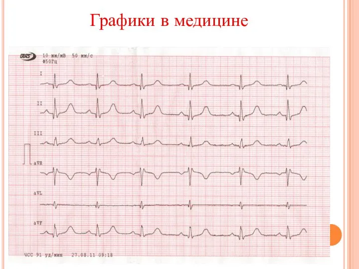 Графики в медицине