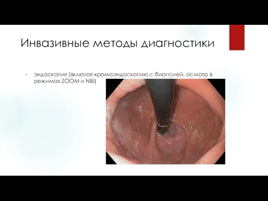 Инвазивные методы диагностики эндоскопия (включая хромоэндоскопию с биопсией, осмотр в режимах ZOOM и NBI)