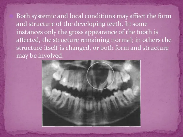 Both systemic and local conditions may affect the form and structure