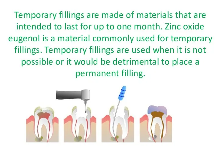 Temporary fillings are made of materials that are intended to last