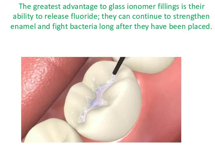 The greatest advantage to glass ionomer fillings is their ability to