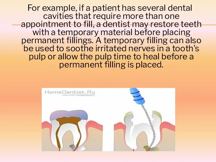 For example, if a patient has several dental cavities that require