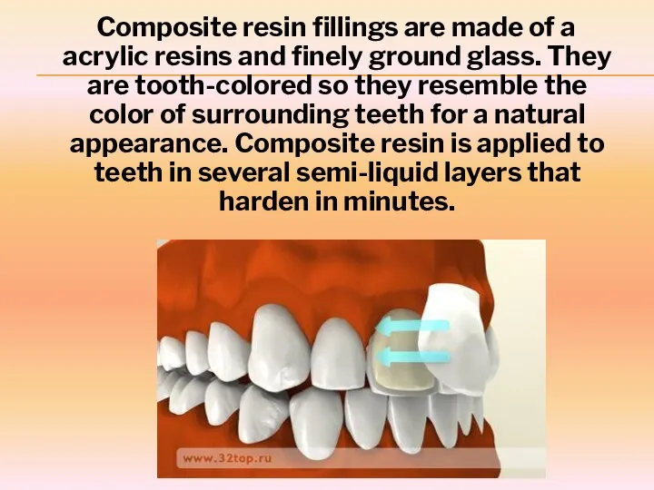 Composite resin fillings are made of a acrylic resins and finely