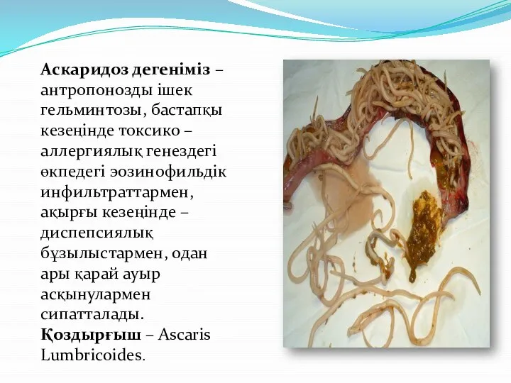 Аскаридоз дегеніміз – антропонозды ішек гельминтозы, бастапқы кезеңінде токсико – аллергиялық