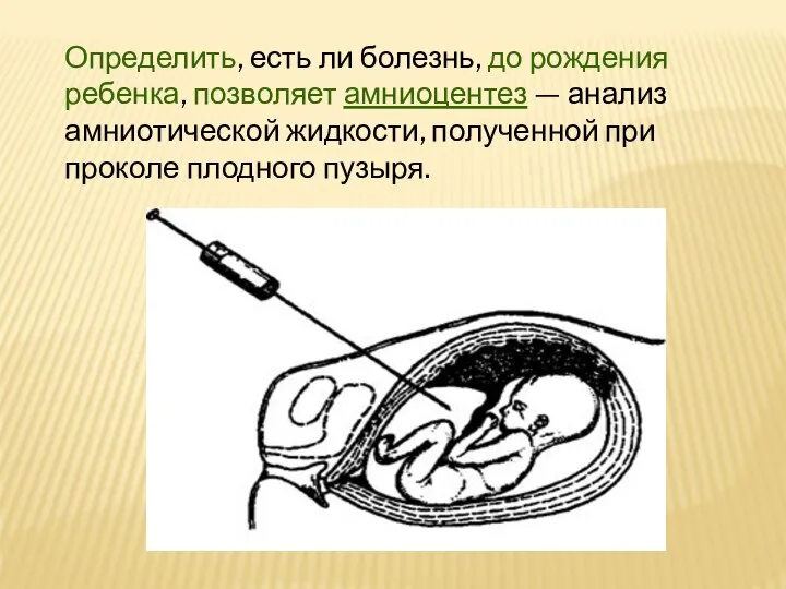 Определить, есть ли болезнь, до рождения ребенка, позволяет амниоцентез — анализ